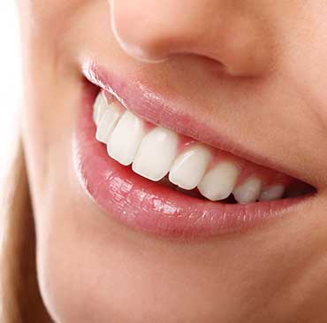 Cosmetic Dentistry | North Calgary Dentist | Northern Hills Dental